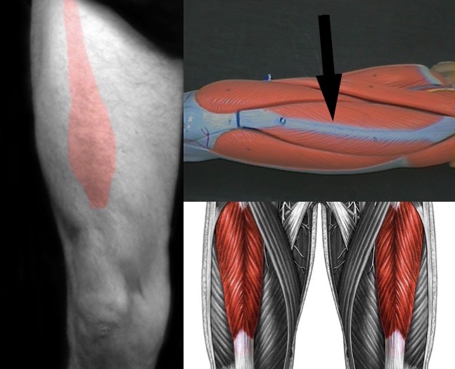 <p>What muscle is this?</p>