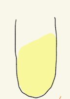 <p>TSI</p>