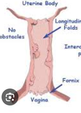 <p>Components of a Mare cervix: </p>