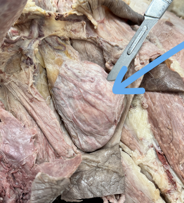 <p>parietal layer of tunical vaginalis</p>