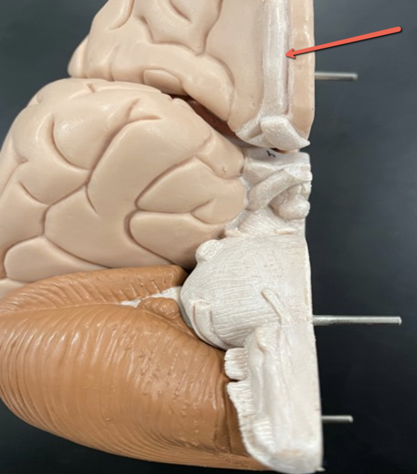 <p><span><strong>Identify the cranial nerve indicated by the pointer.</strong></span></p>