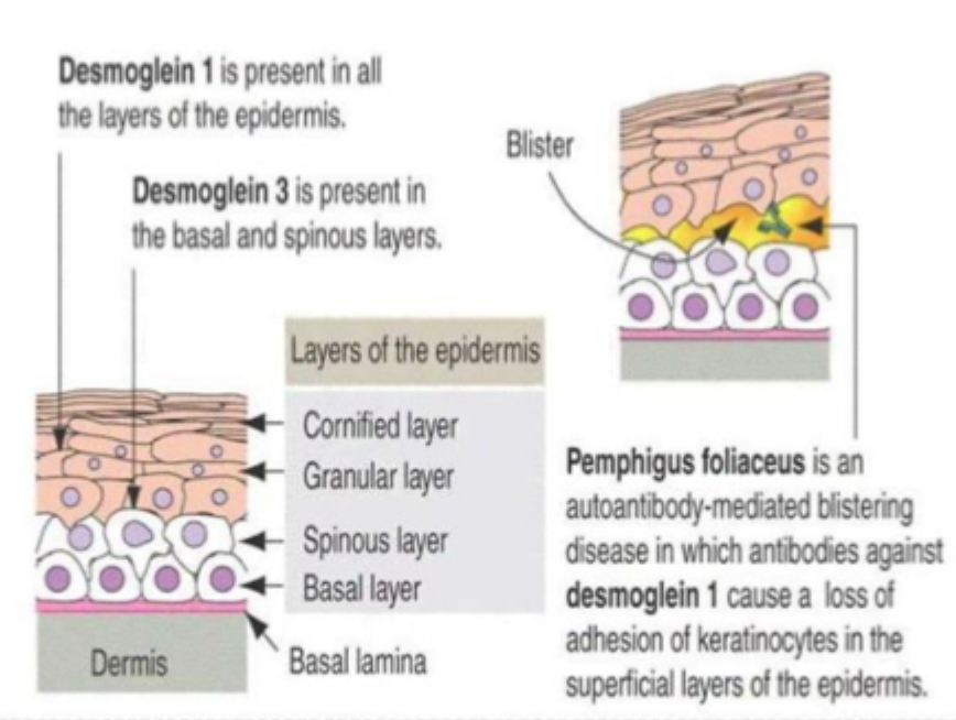 <p>Hvorfor er desmosomer særligt vigtige i hud?</p>