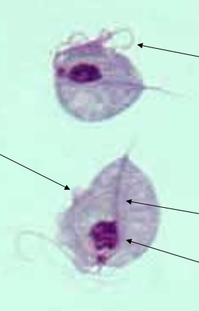 <p>Identify the Protozoa</p>