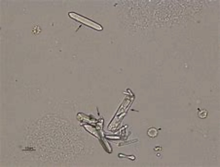 <ul><li><p>Small and dumbbell shaped.</p></li><li><p>Resemble a slat from a picket fence.</p></li><li><p>A large number is seen in animals with ethylene glycol (antifreeze) toxicity.</p></li></ul><p></p>