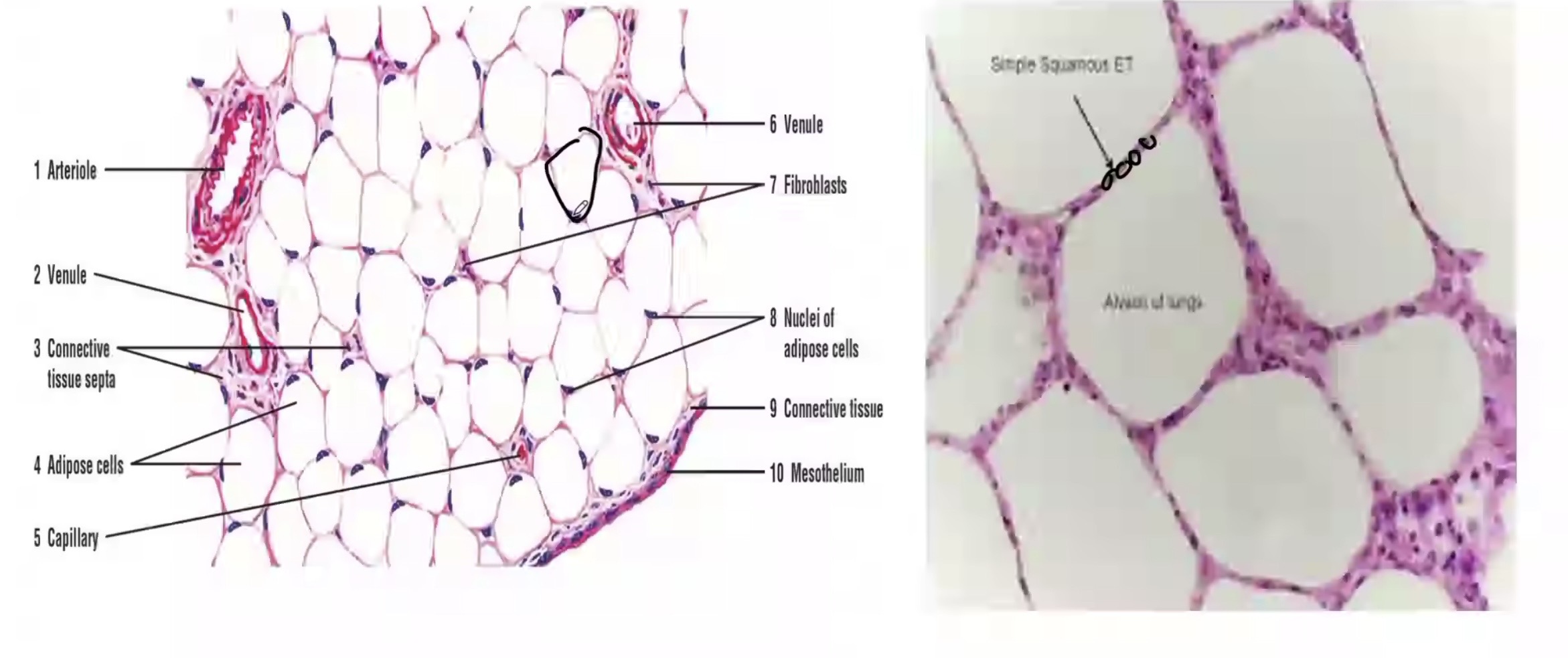 <p>Difference of connective and simple squamous epithelial tissue </p>