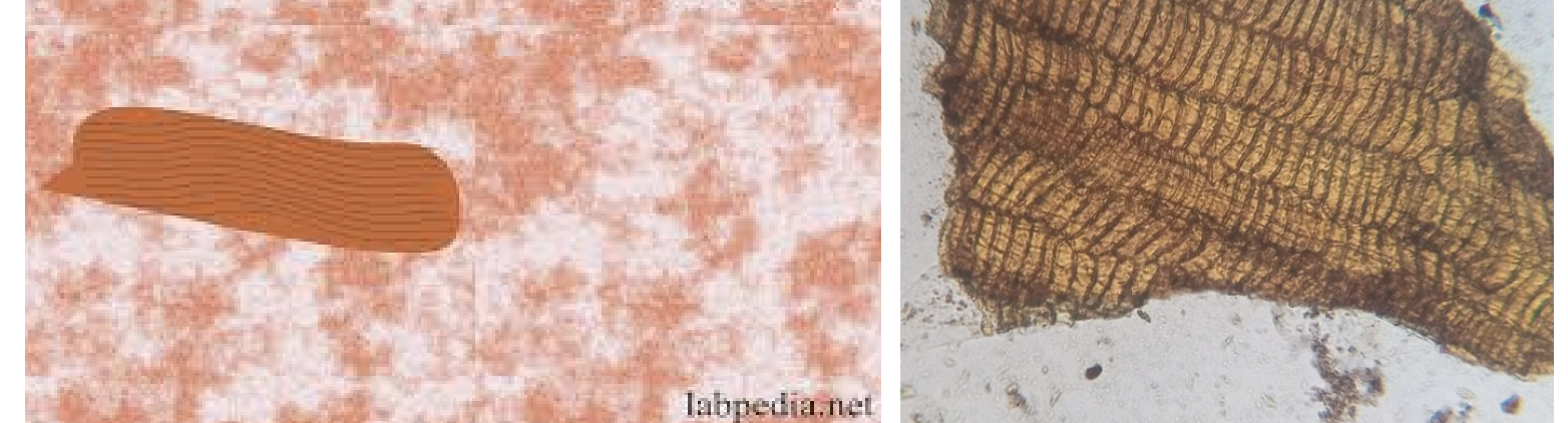 <p>seen in microscopic stool exam</p>