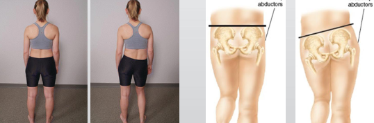 <p>low back pain physical exam tests?</p>