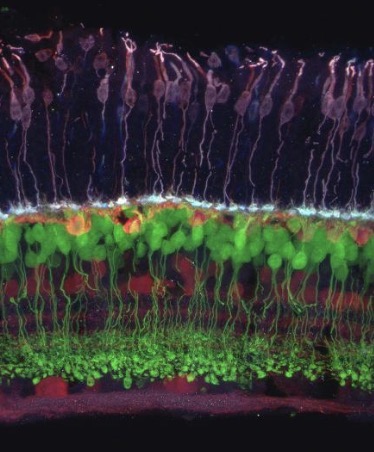 <p>What is the green part</p>