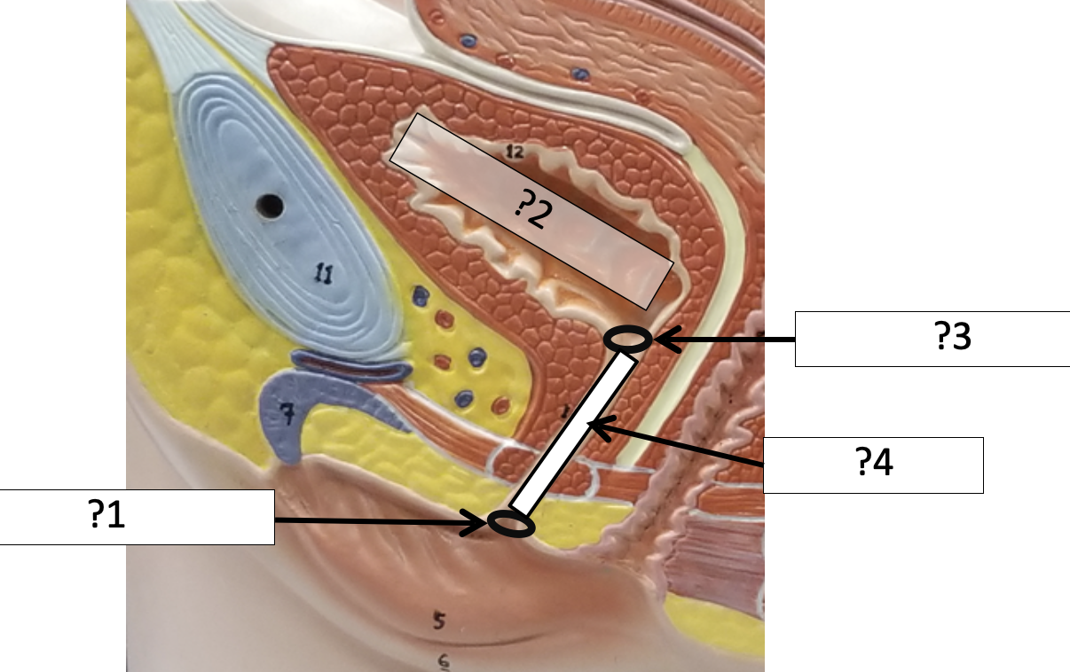 <p>3 Name the hole?</p>