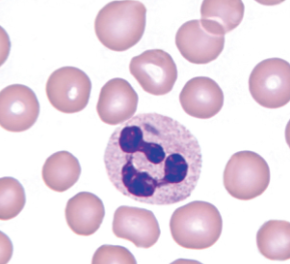 <p>What are dohle bodies, in which cells are they found, and what do they look like?</p>