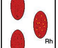 <p>What is the blood type indicated by the results in the right tray?</p>