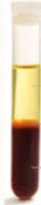 <p>What are the 3 layers in this sample, is this plasma or serum?</p>