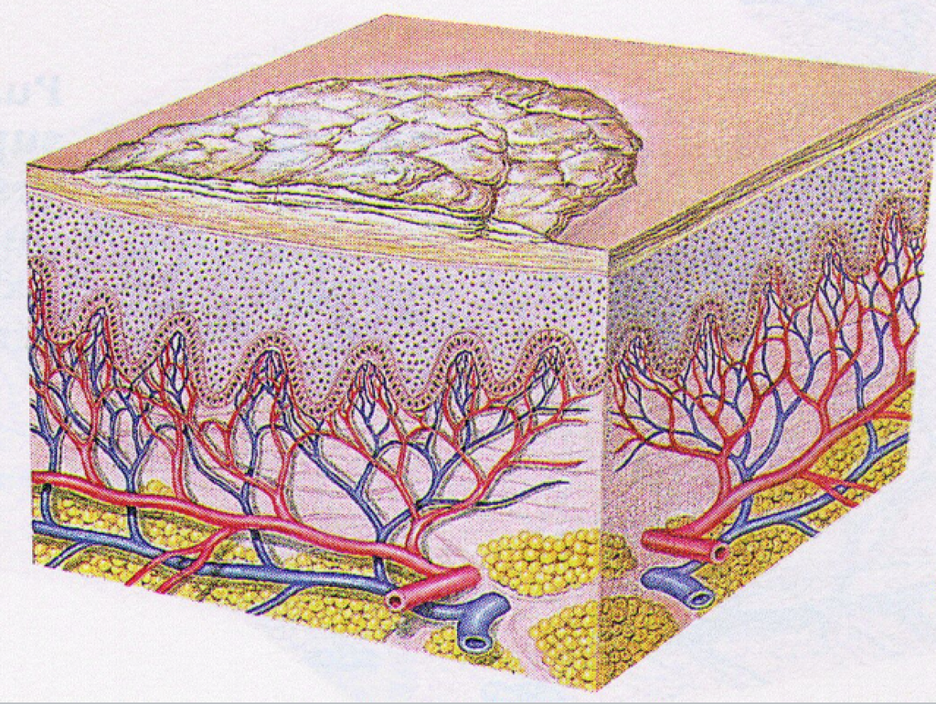 <p>Thin or thick flake of skin varying in color; usually secondary to desquamated, dead epithelium<br>Ex. Dandruff</p><p>Secondary Lesion</p>