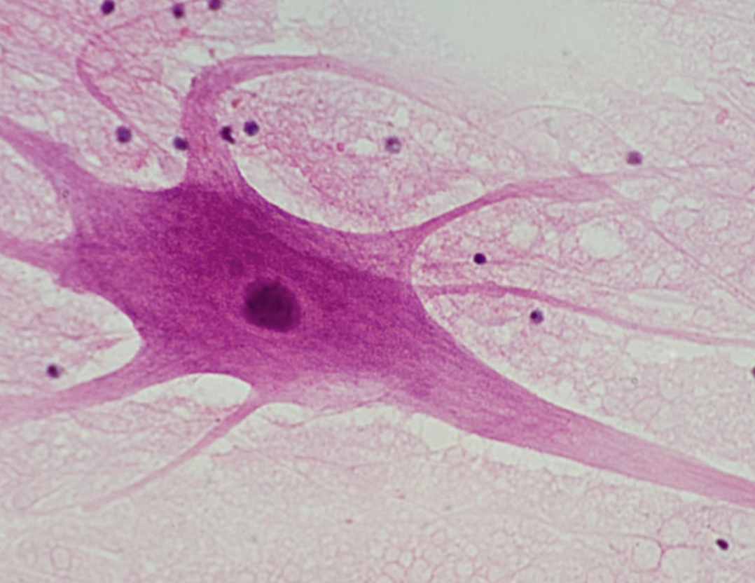 <p>A longer process emanating from the cell body to make contact with other neurons, muscle cells, or gland cells. It does not contain chromatophilic substances, but may be insulated by the myelin sheath, they are responsible for the initiation and propagation of action potentials (large electrical charges) </p>