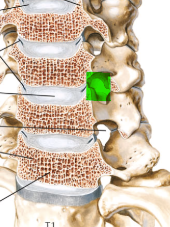 <p>Space between the pedicles of two adjacent vertebrae, to allow for spinal nerve passage. </p>