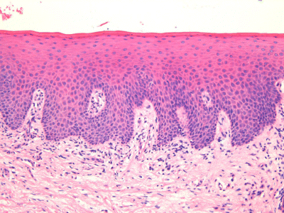 <p><strong>moist, protective lining</strong> of mouth</p><p>essential for <strong>protection, sensation, oral function</strong></p><p></p><ul><li><p>stratified squamous epithelium</p></li></ul><p></p>