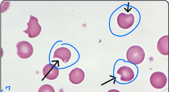 <p>what type of erythrocyte cell is this?</p>