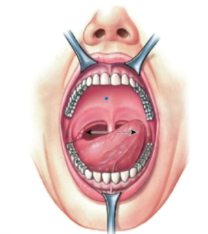 knowt flashcard image