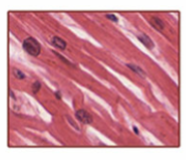 <p>striated, branched, and uninucleated fibers, involuntary, only covers walls of the heart</p>