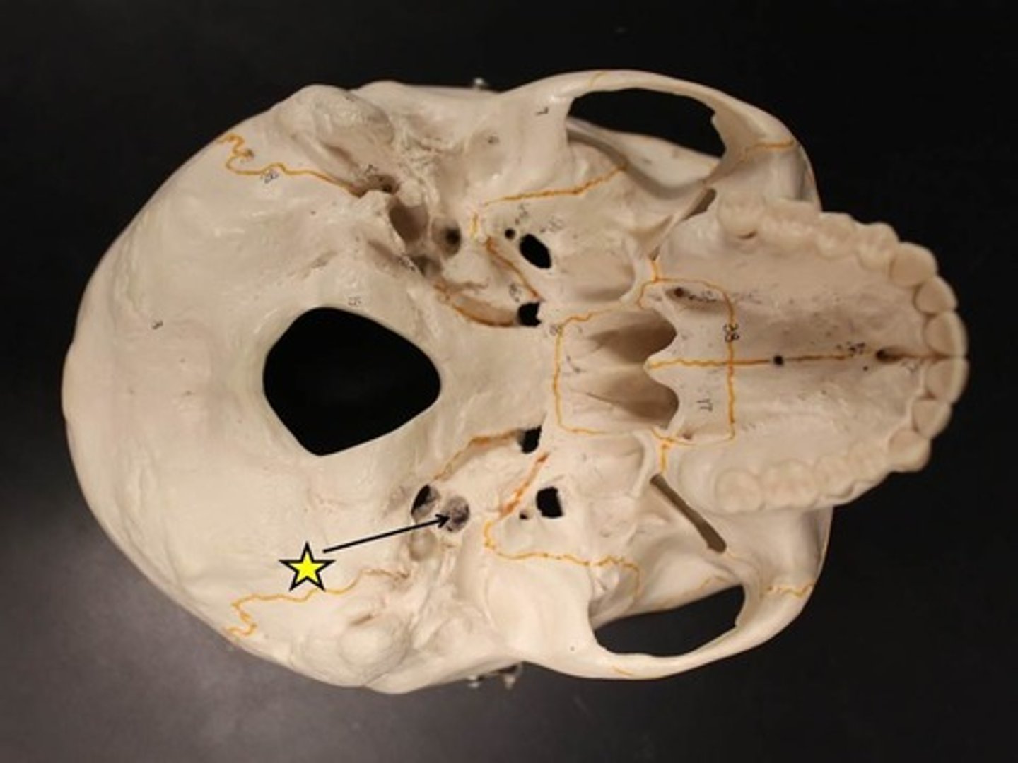 <p>ID opening at tip of pointer</p>