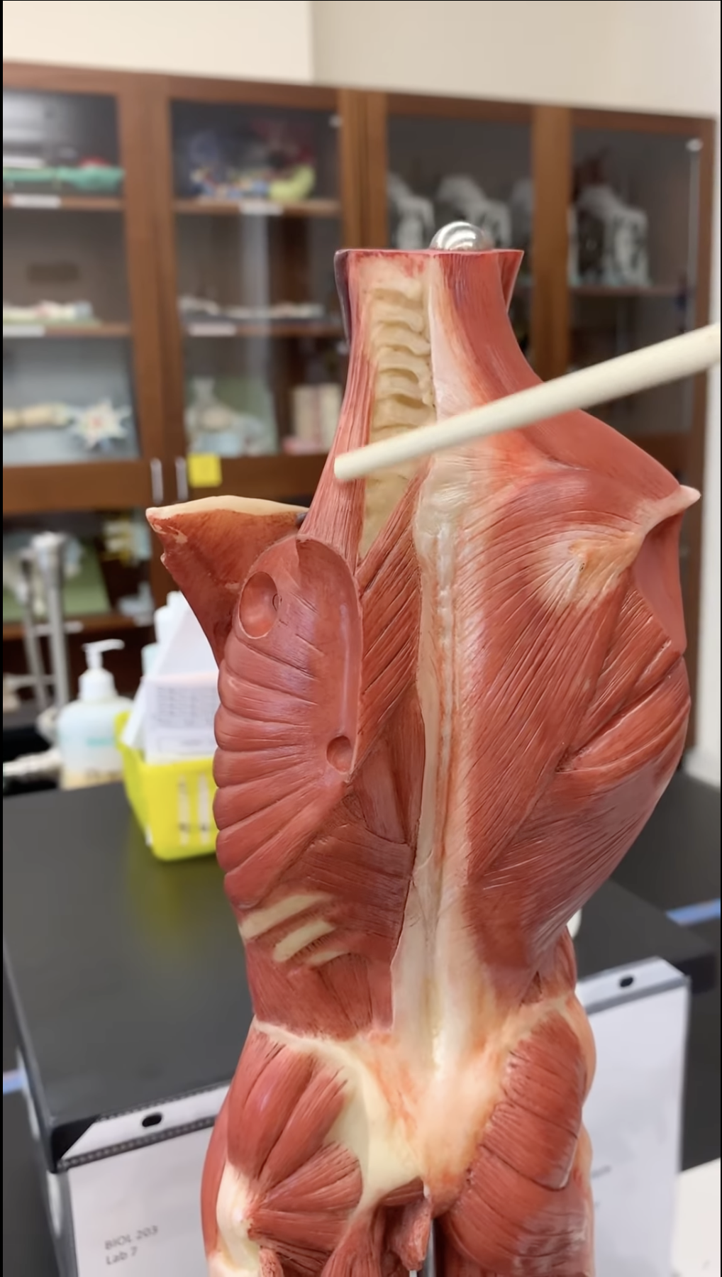 <p>Levator Scapulae (O, I, A)</p>