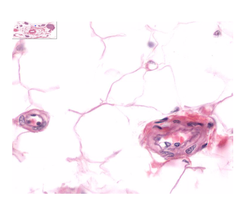 <p>What are arterioles? What connects arterioles to venules?</p>