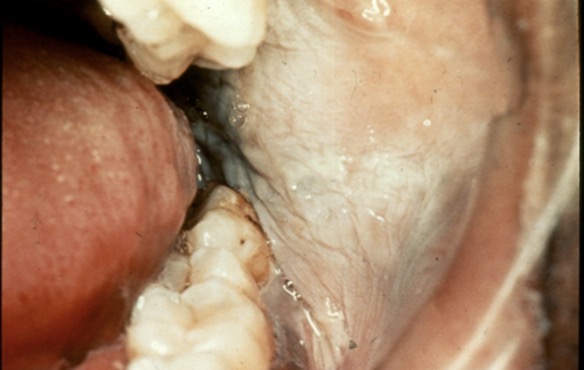 <p>What is this condition?</p>