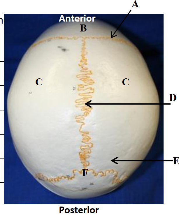 <p>What kind of suture is at letter A?</p>