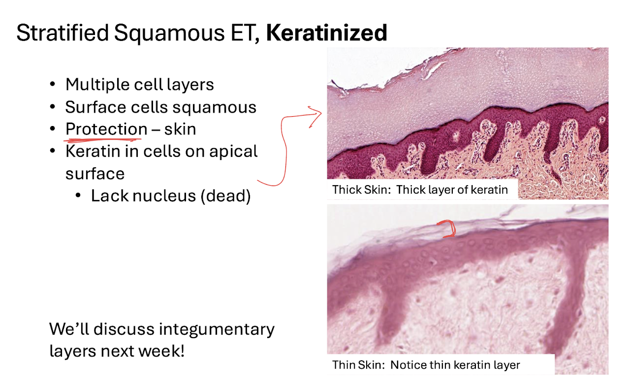 <p>Protection</p><ul><li><p>FOUND IN SKIN</p></li><li><p>Multiple layers → cells can be shed/replaced → underlying tissues remain protected.</p></li></ul><p></p>