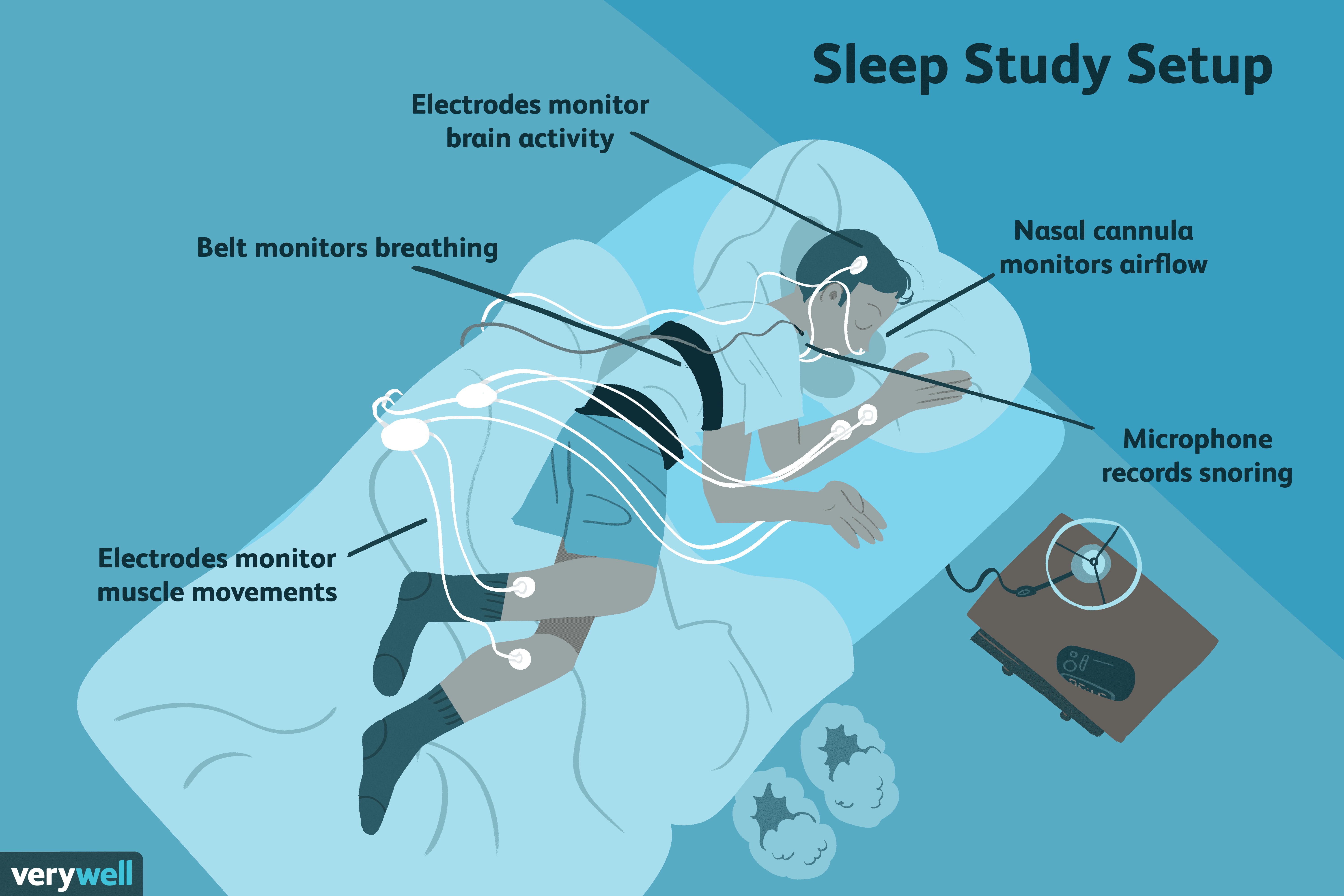 <p>a multi-parameter sleep study used as a diagnostic tool in sleep medicine</p>