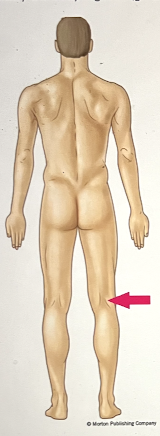 <p>identify the body region</p>