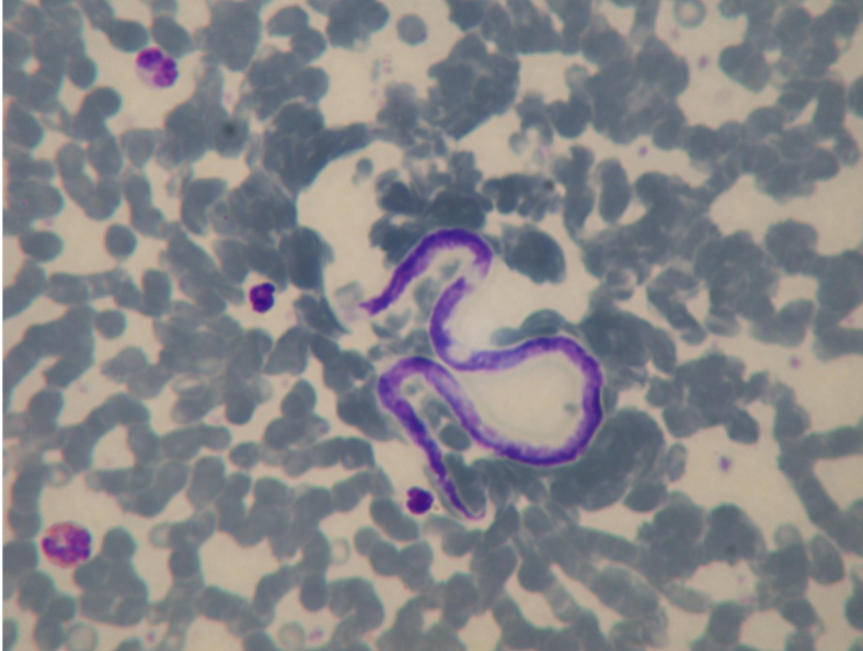 <p>What is the kingdom, phylum, order, and family of this parasite</p>