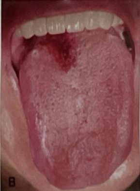 <p>CHẨN ĐOÁN?</p>