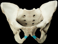 <p>Pass down & posterior from symphysis pubis to meet the ramus of ischium</p>