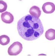 <p>Key Cells of the immune system: Neutrophils</p>