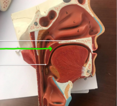 <p>What structure is the green arrow pointing to?</p>