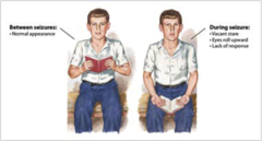 <p>Absence seizures, lapses in awareness (staring into space), repeated movements like lip-smacking</p>