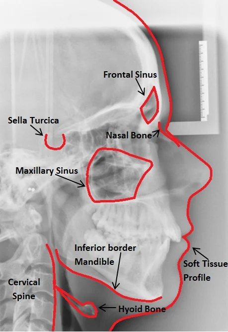 <p>purpose of cephalometric </p>