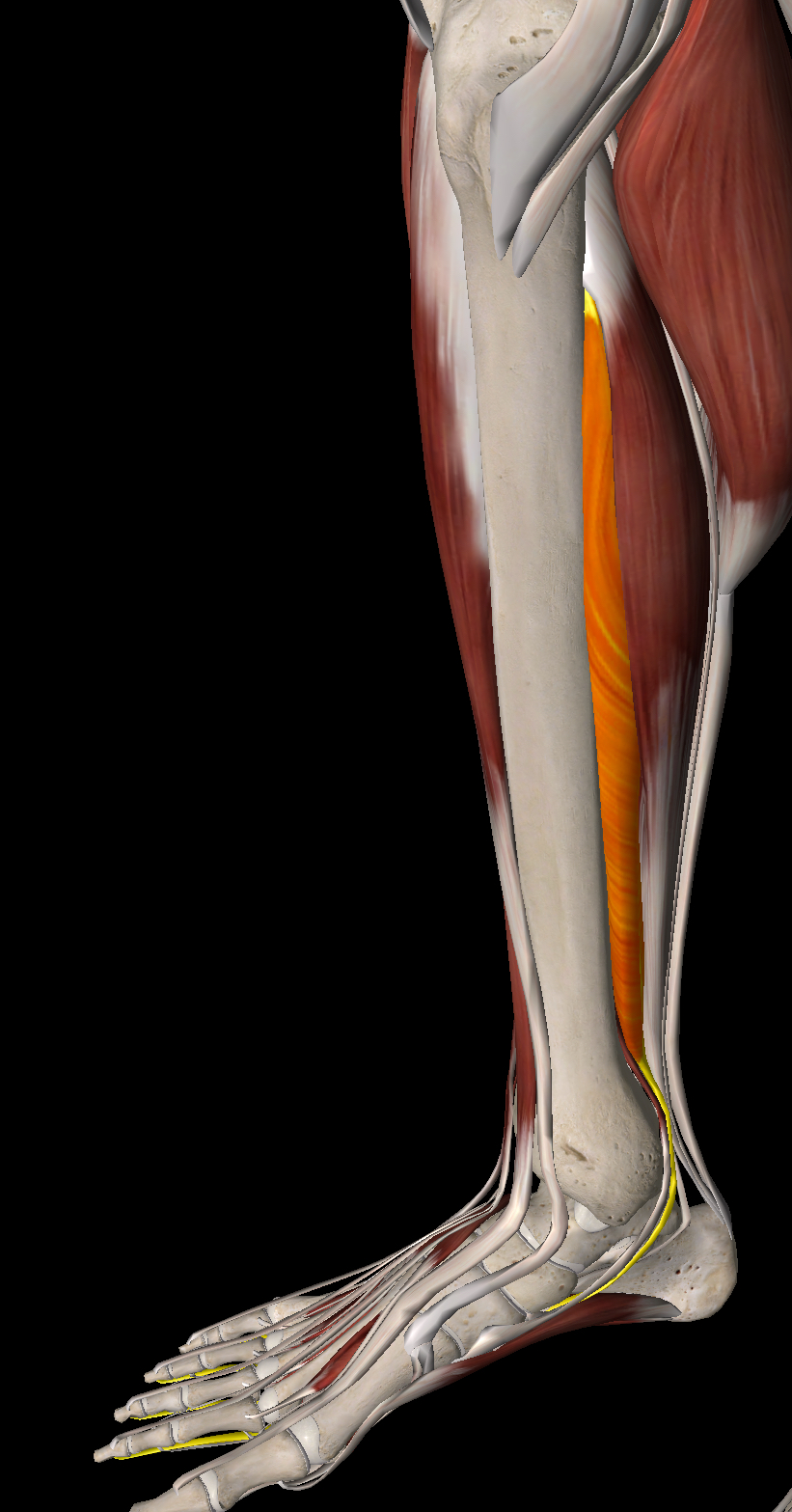 <p>What muscle is this?</p>