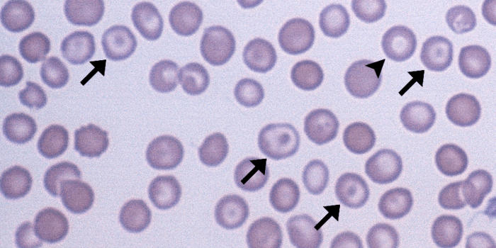 <p>What kind of RBCs are these (2 names)? Describe it. </p>