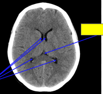 <p>Name the structure</p>