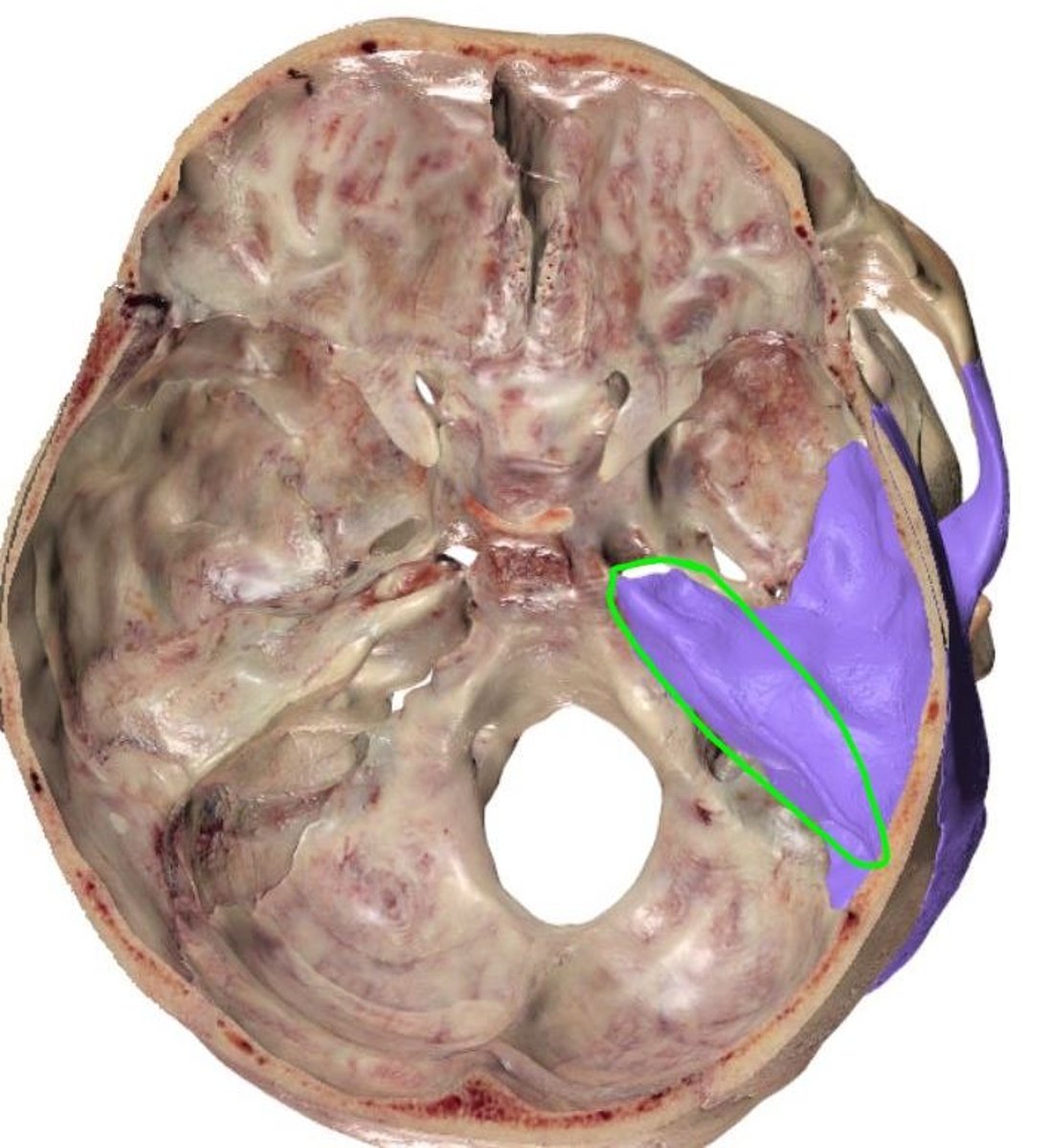 <p>What part of the bone is this?</p>