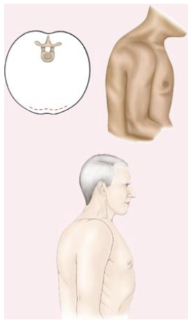 <p>AP lateral ratio 1:1</p>