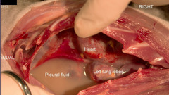 <p>If I were to tell you this effusion smells very bad (which you find out is due to anaerobic bacteria) and you can see that the left lung lobes are fibrinous and collapsed, what is your first differential for what type of effusion this is?</p>