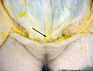 <p>what ligament is shown in the image</p>