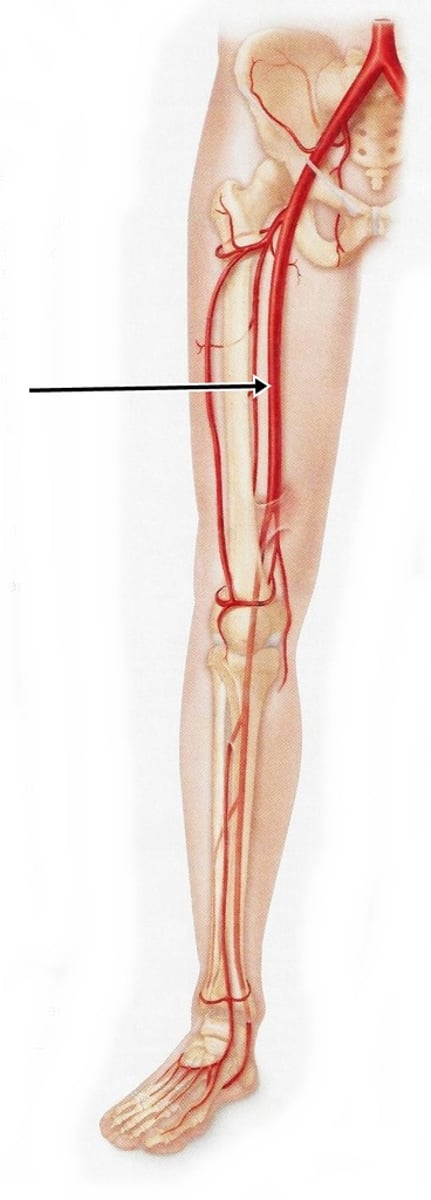 <p>the major artery supplying the leg</p>