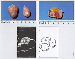 <p>During estrus there is follicle maturation, and final follicular maturation occurs in metestrus. What IS the follicle?</p>