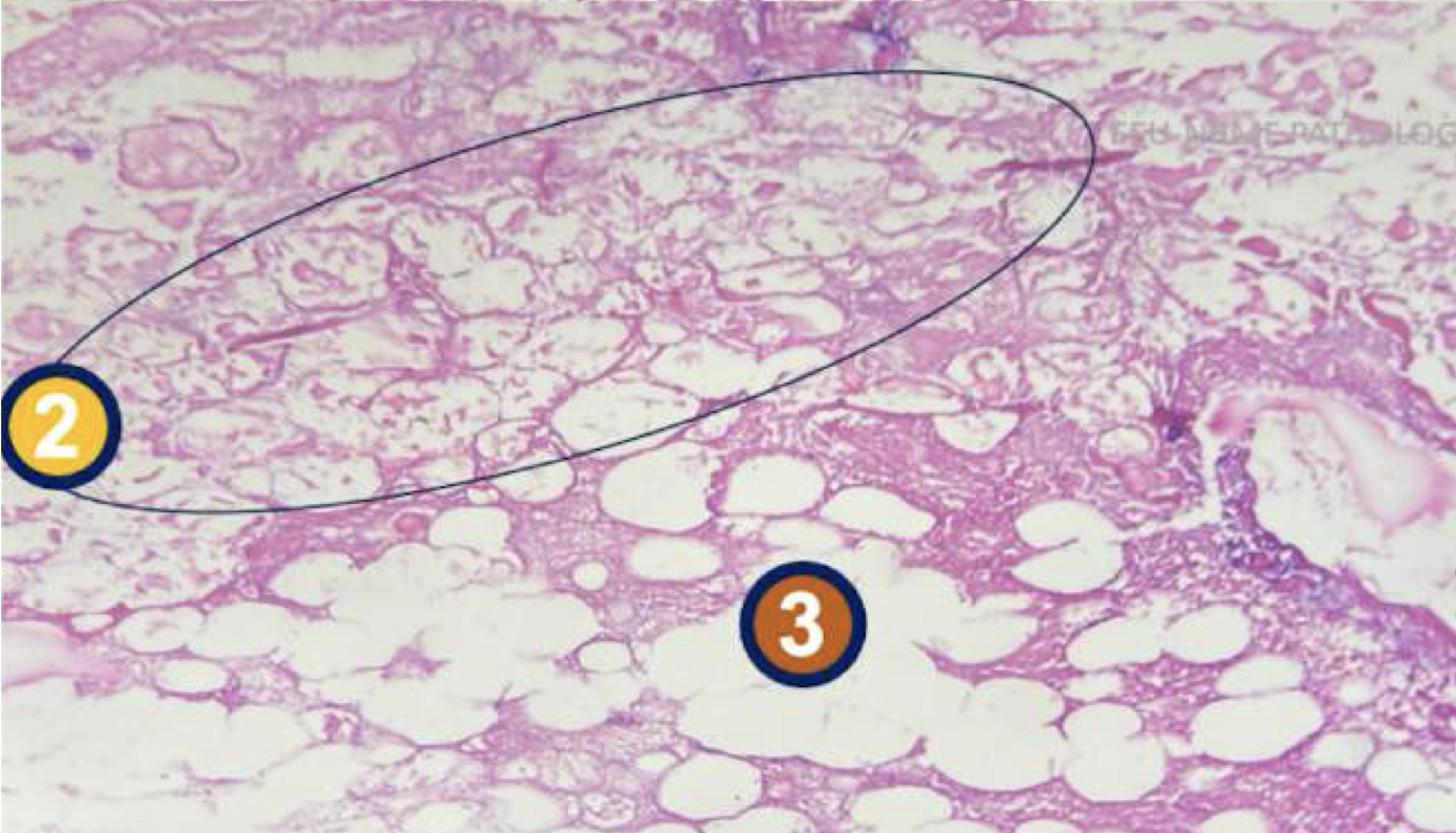 <p>diagnose and identify pointed structure</p>