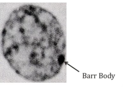 <p>- Barr bodies in nucleus → inactivated X chromosome</p>
