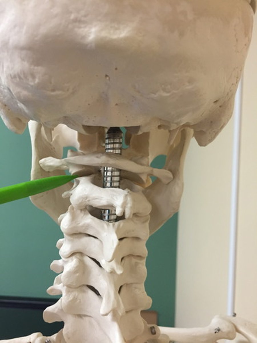 <p>are uniaxial joints for rotation</p><p>ex. atlanto axial joint</p>